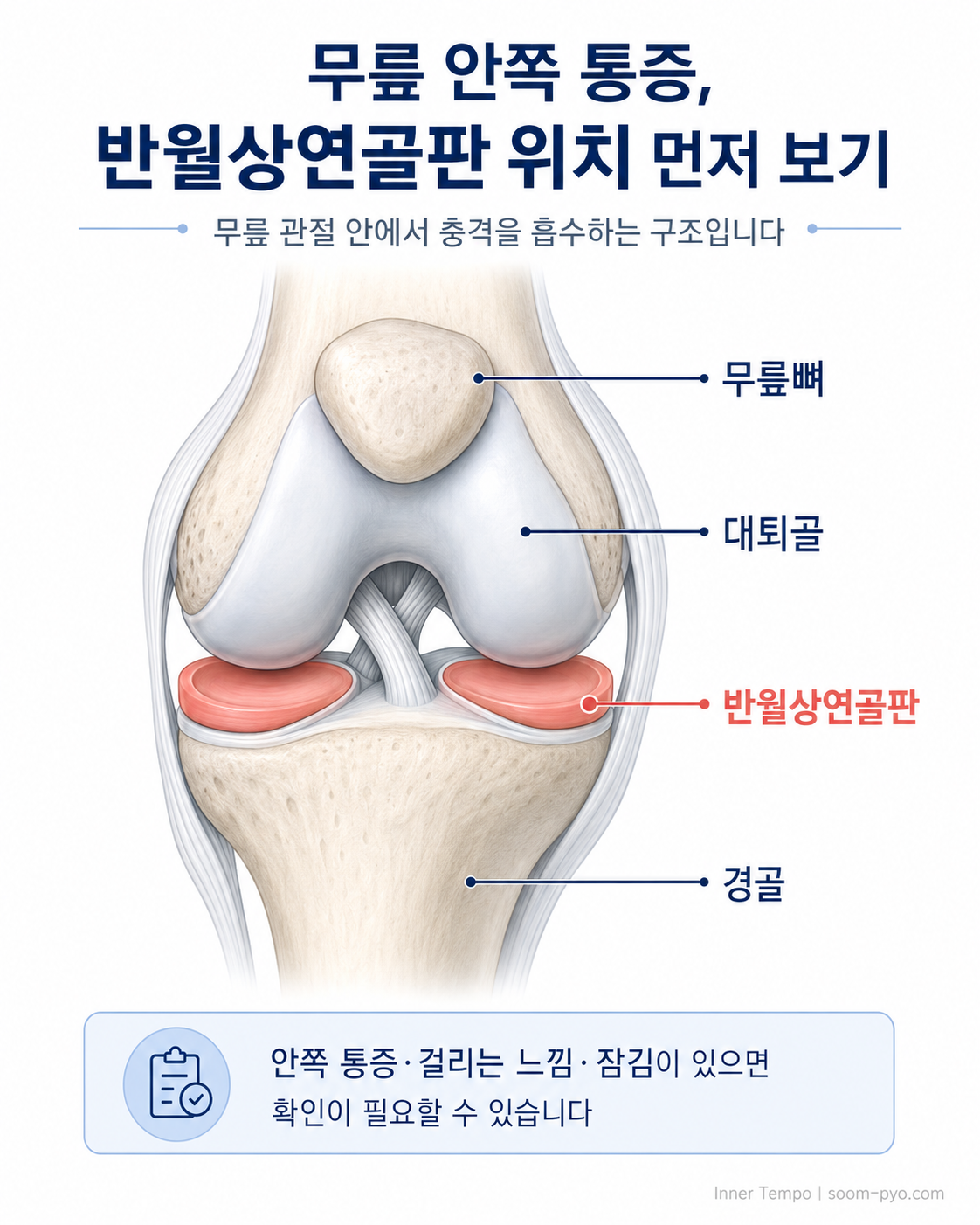 무릎 반월상연골판 구조 설명