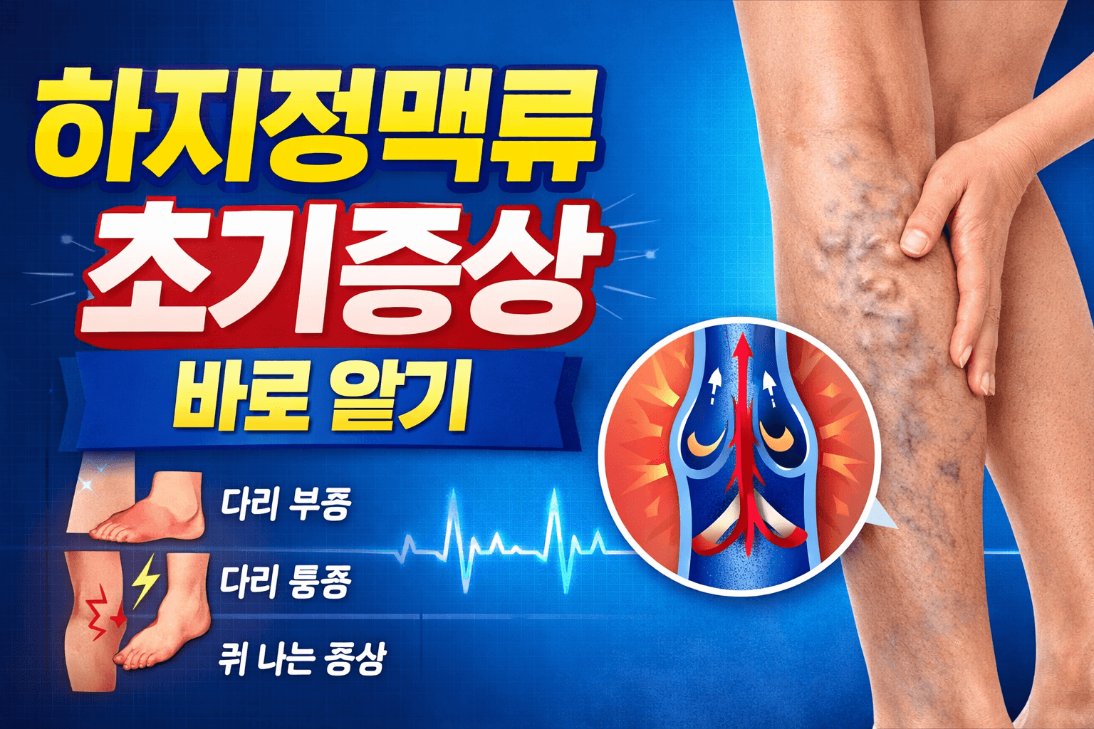 하지정맥류 초기증상, 다리가 붓고 무거울 때 절대 놓치면 안 되는 신호!