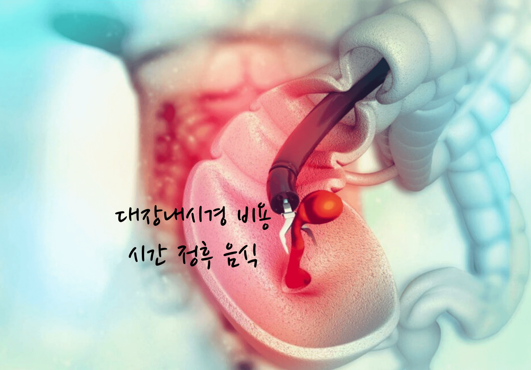 대장내시경