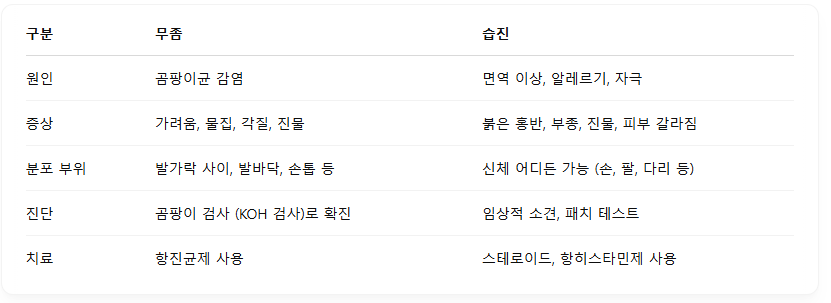 무좀과-습진-차이