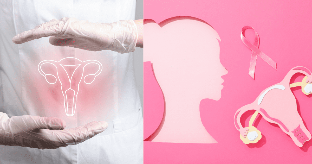 여성의 자궁을 든 의사의 손들과 여성과 자궁 모형