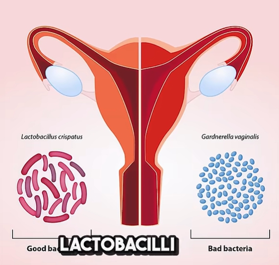 생리 냄새가 지독해요