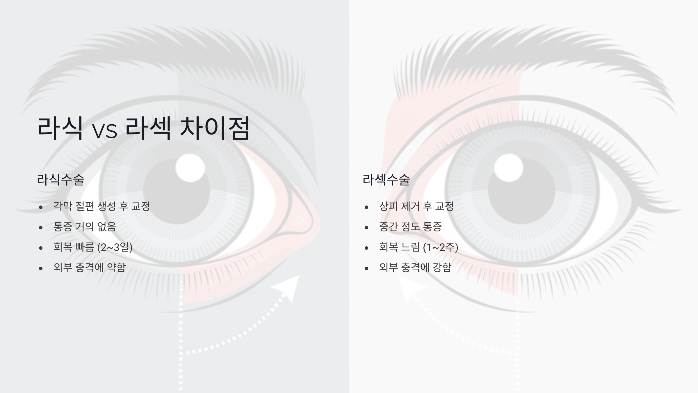 라식수술과 라섹수술의 주요 차이점
