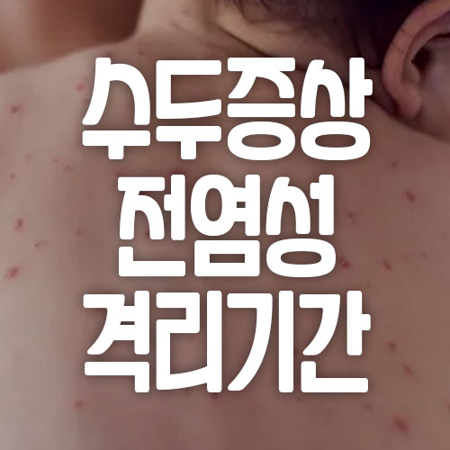 수두증상 전염성 격리기간