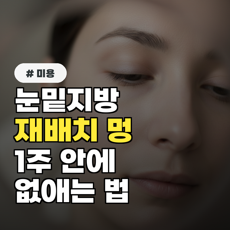 눈밑지방재배치 후 멍, '이 방법'으로 1주 안에 없애세요!