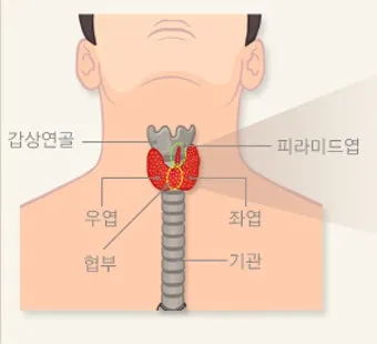 갑상선 기능 저하증 증상 6가지는 무엇인지 알아보기_21