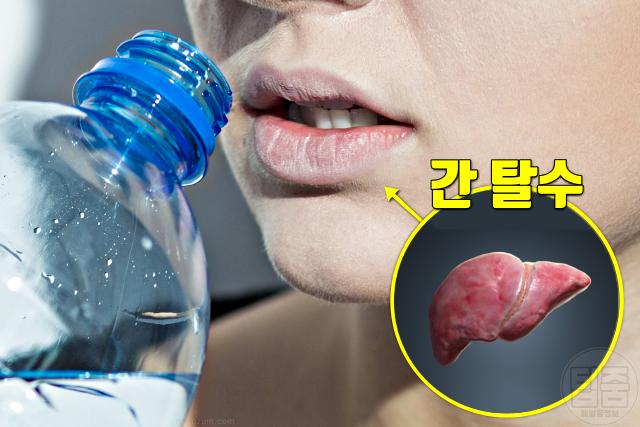 간에 안좋은 행동 습관 간 전문의 추천 수분