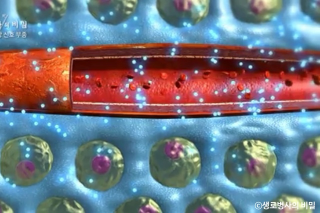 종아리 얼굴 붓는 이유, 붓기 부기 부종 원인 증상, 생로병사의 비밀, 다이어트 건강, 팁줌 매일꿀정보