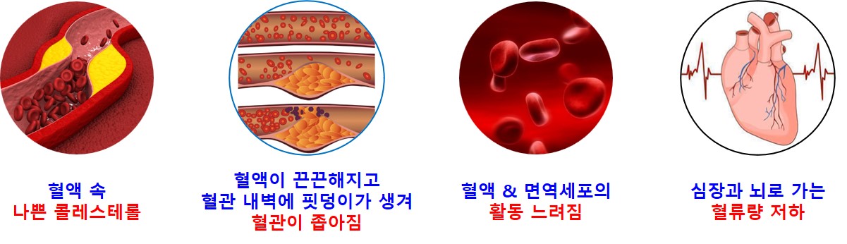 혈관건강