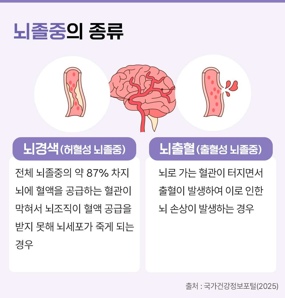 #뇌졸중의 종류 #뇌경색 허혈성 뇌졸중 #뇌출혈 출혈성 뇌졸중