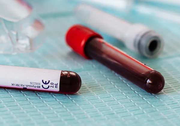 당화혈색소 낮추기