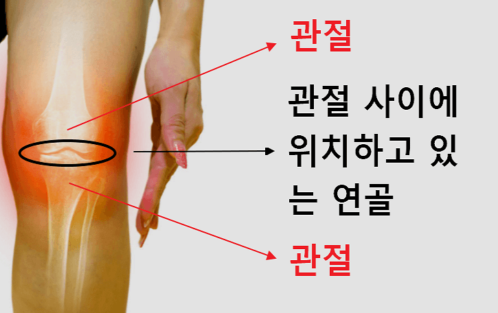 연골의 위치