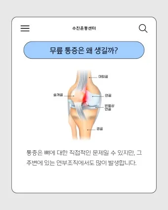 무릎 통증 원인 치료방법 치료약으로_4