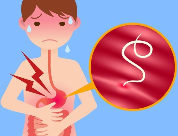 신장결석 / 요로결석