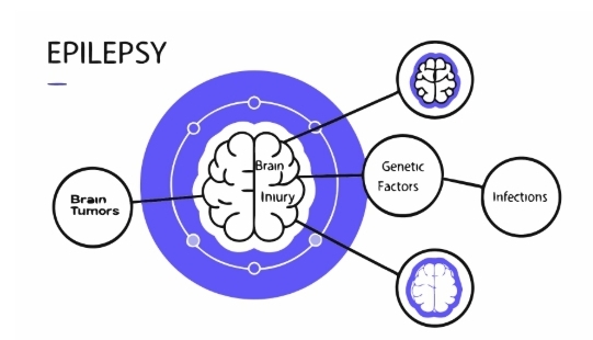 뇌전증 의심증상