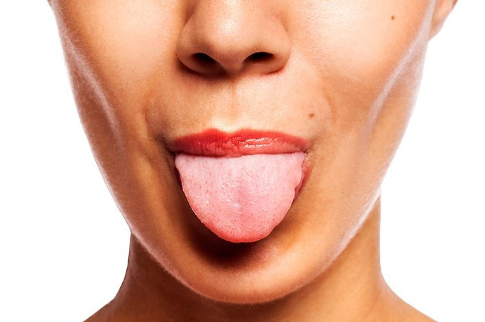 혓바늘 없애는 방법