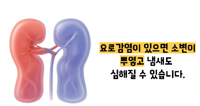 소변이 탁한이유