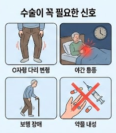 무릎 인공관절 수술