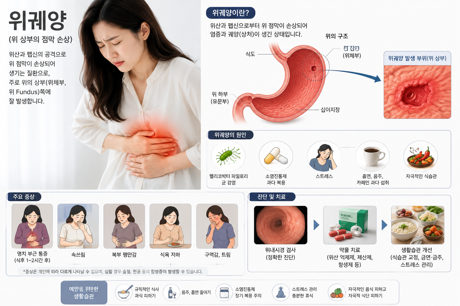 위궤양