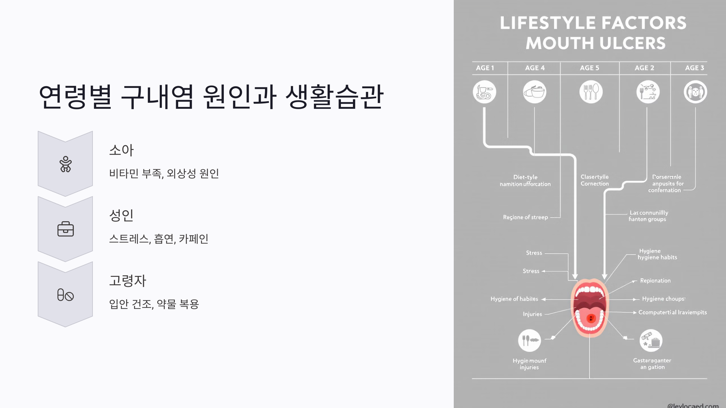 연령별 구내염 원인 차이와 생활습관 개선 방향