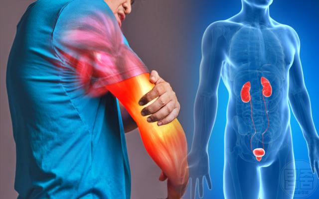 신장에 안좋은 습관 횡문근 융해증