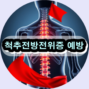 척추전방전위증 치료, 척추전방전위증 수술비용, 척추전방전위증 증상 및 검사, 요추 전방전위증 치료방법, 허리 통증 전문 병원, 허리 수술 비용 견적, 비수술 척추 치료, 척추 안정화 운동 법, 척추 질환 정형외과, 허리 수술 후기 / 케이스 스터디