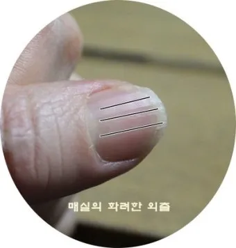 손톱이 갈라지는 이유 원인 증상 대처법_6
