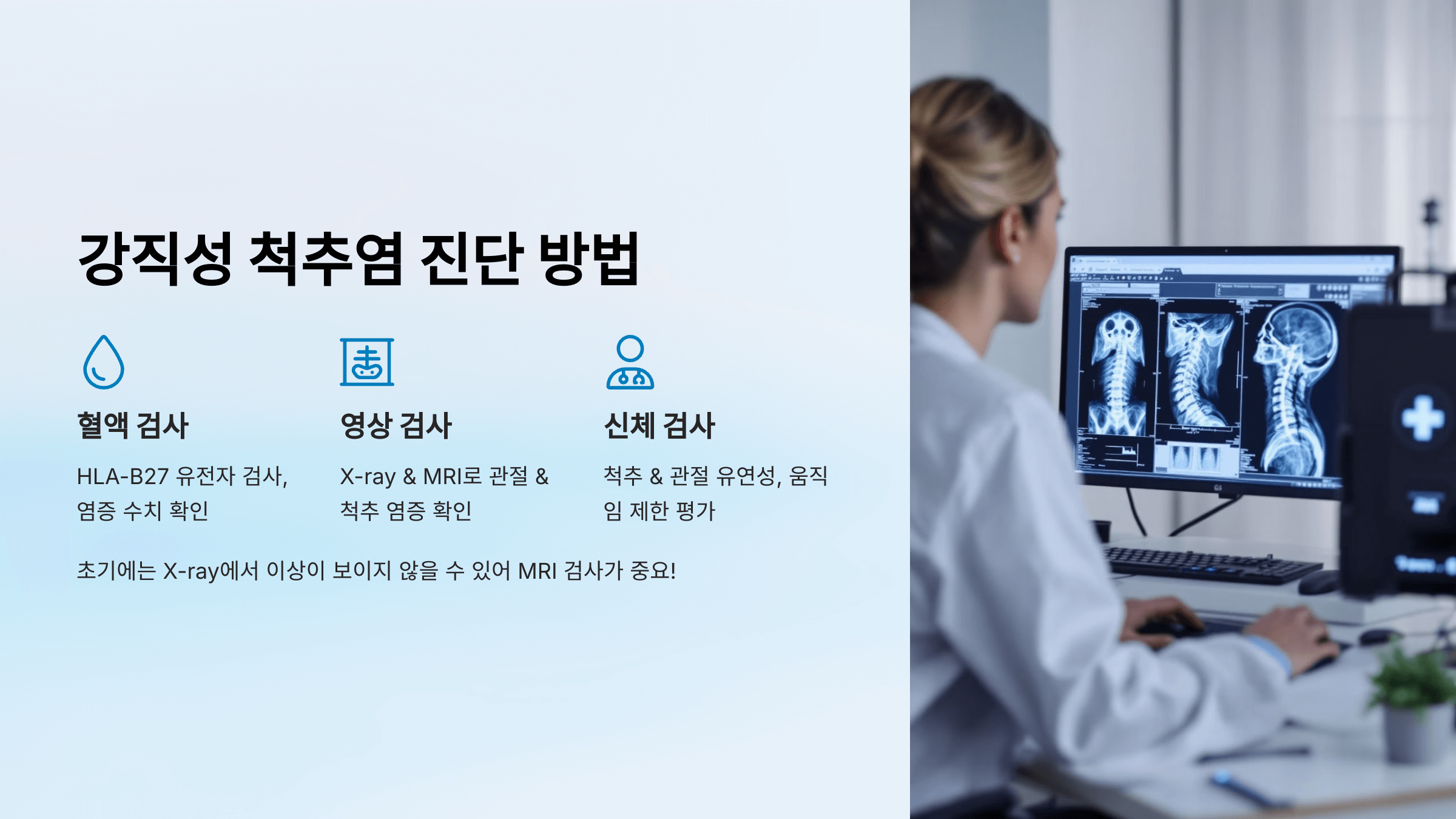 강직성 척추염과 관련된 사진입니다.