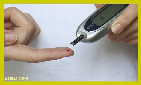 신경계 질환종류 사진