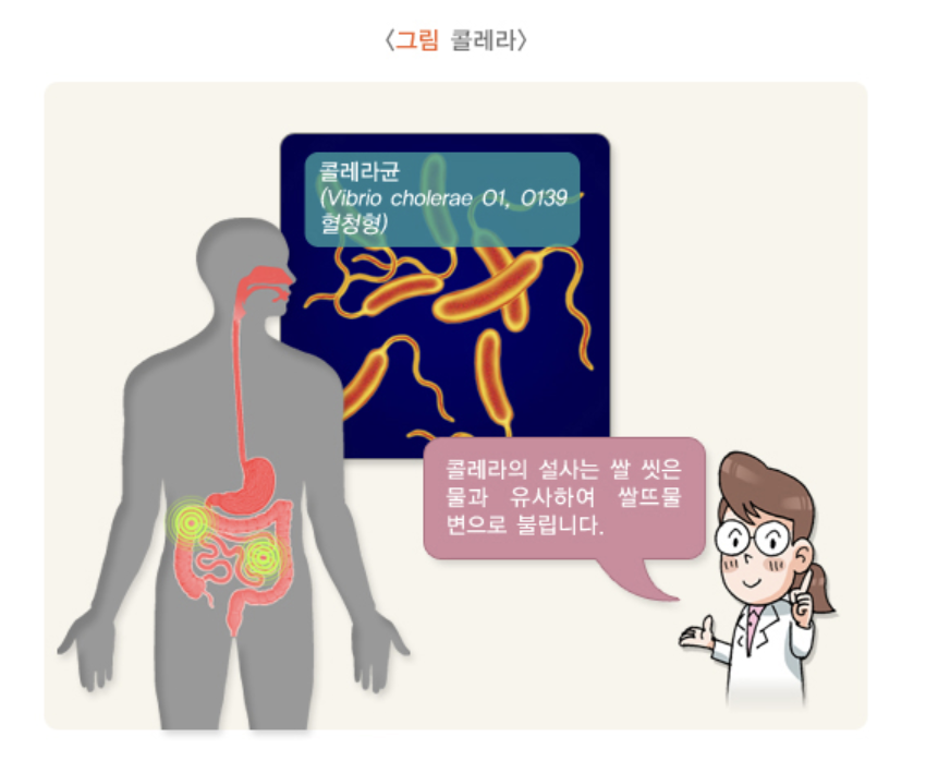 콜레라 증상
