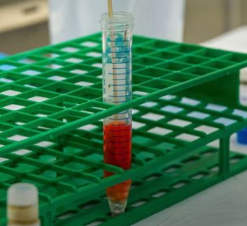 만성 방광염 치료 방법 진단 기준 합병증