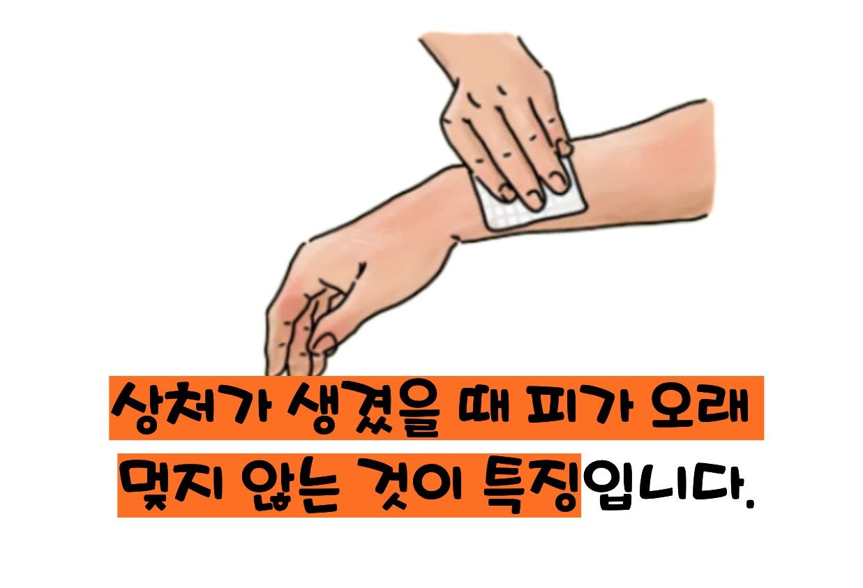 혈소판 감소증 증상