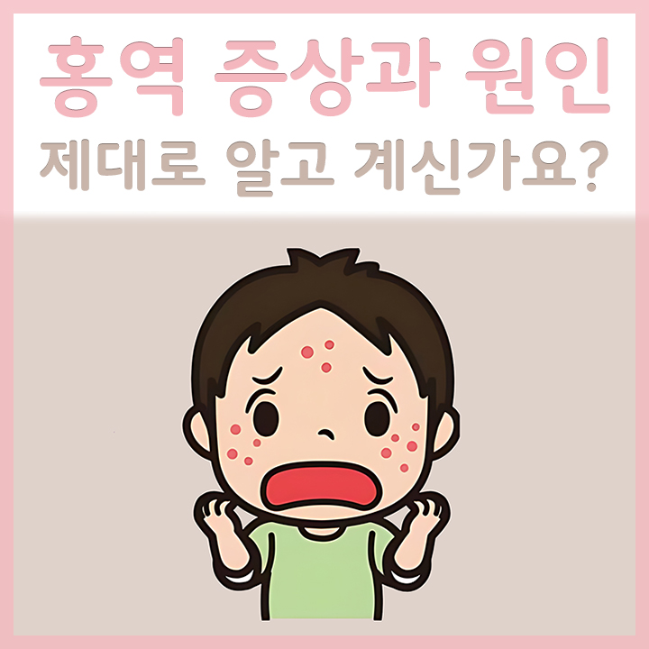 홍역