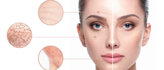 피부미용 효과/출처:어도비스톡