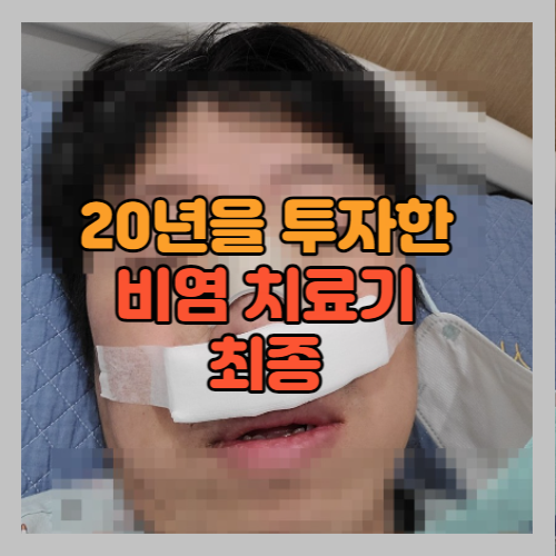 20년을 투자한 비염 치료기 최종본 썸네일