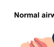 마운자로 효과입증