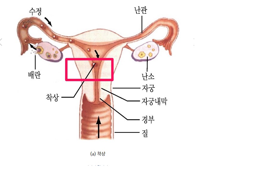 임신 착상