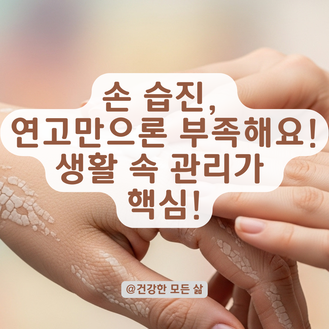 흡수가 안 되는 손 습진, 연고보다 중요한 생활 관리법 알아보기.