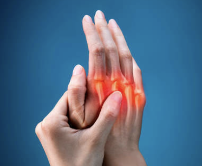 퇴행성관절염 증상 33