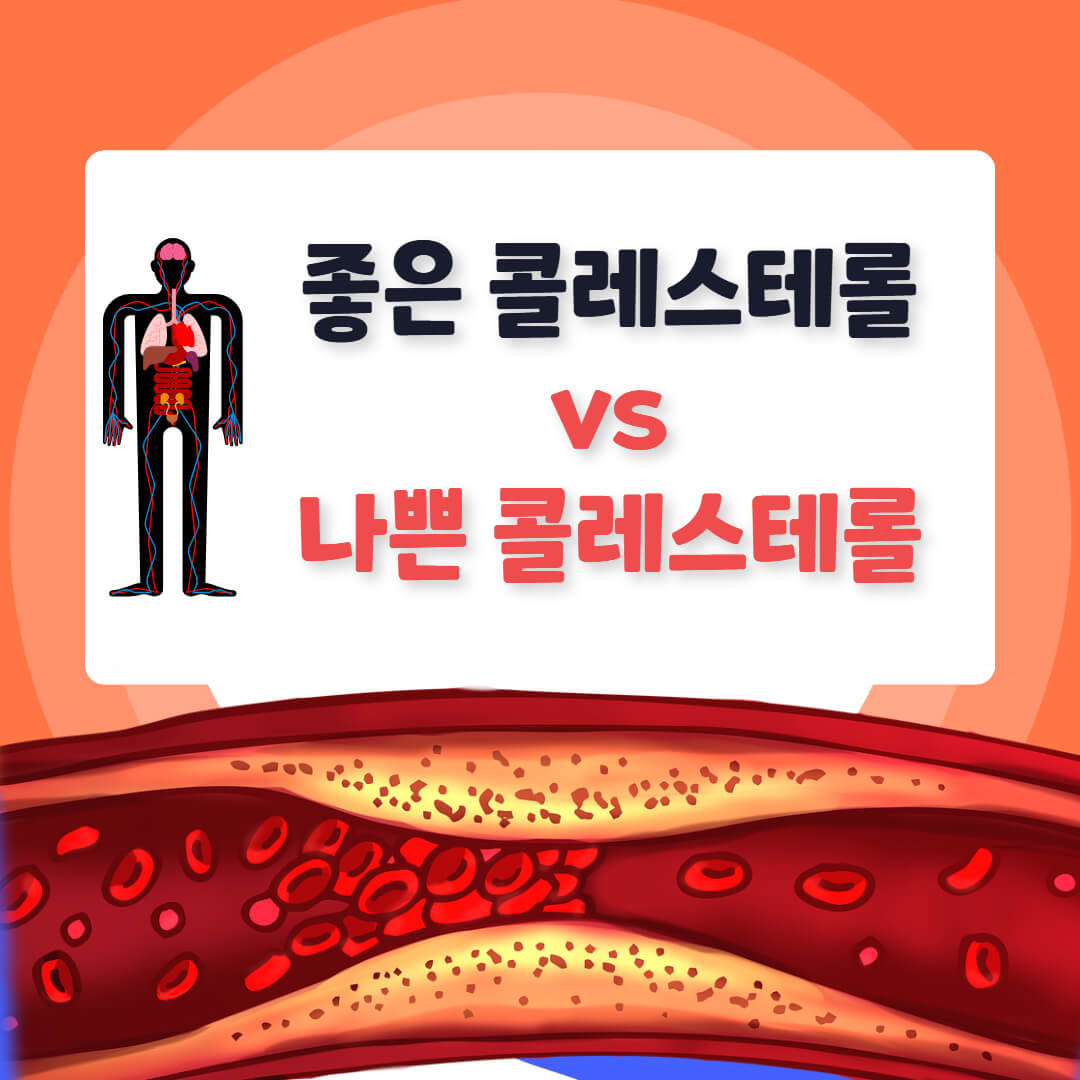 좋은 콜레스테롤 나쁜 콜레스테롤