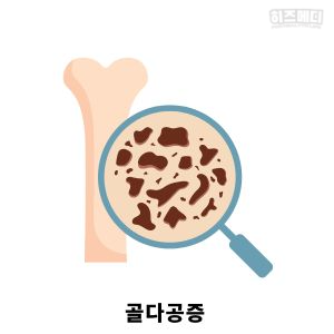 폐경 증상