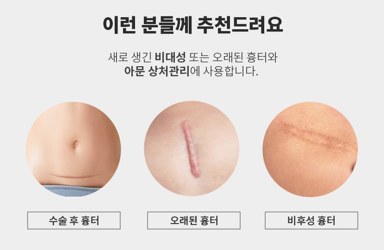 시카슈어 밴드 설명3