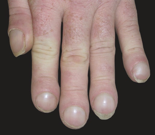 손가락이 &lsquo;이 모양&rsquo; 이라면&hellip; 당장 병원부터 가세요.