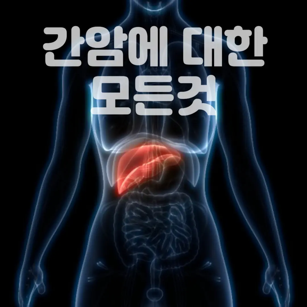 간암의모든것