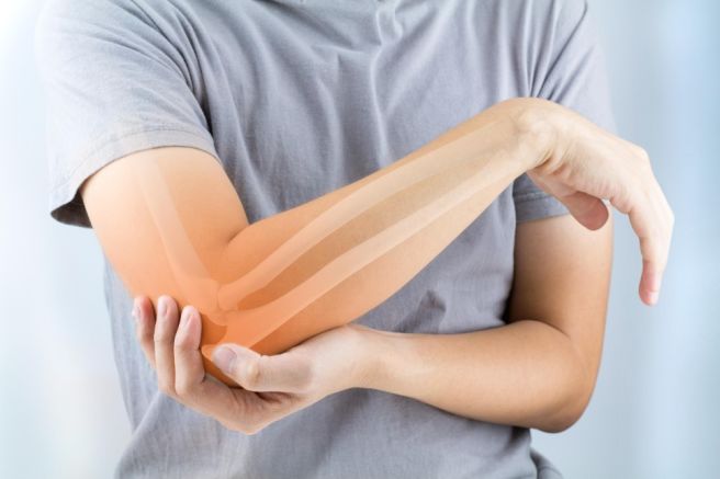 팔꿈치 바깥쪽 통증
