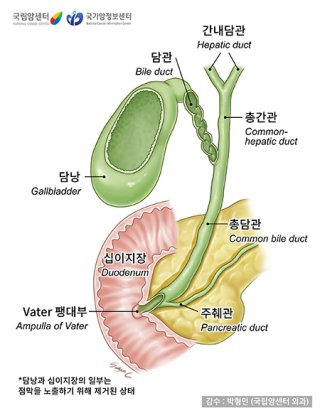 담도암 담낭암 차이