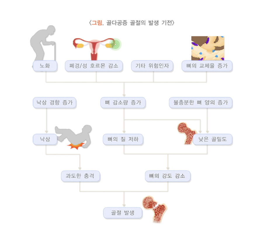 골다공증 발생 기전