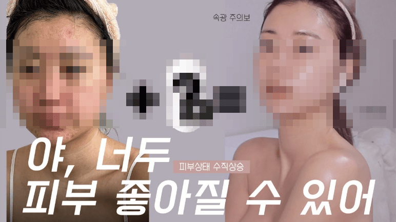 유튜브 썸네일 - 글로웍스 사용 전후 사진