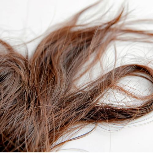 양모모발증후군 관리법 꼬인머리