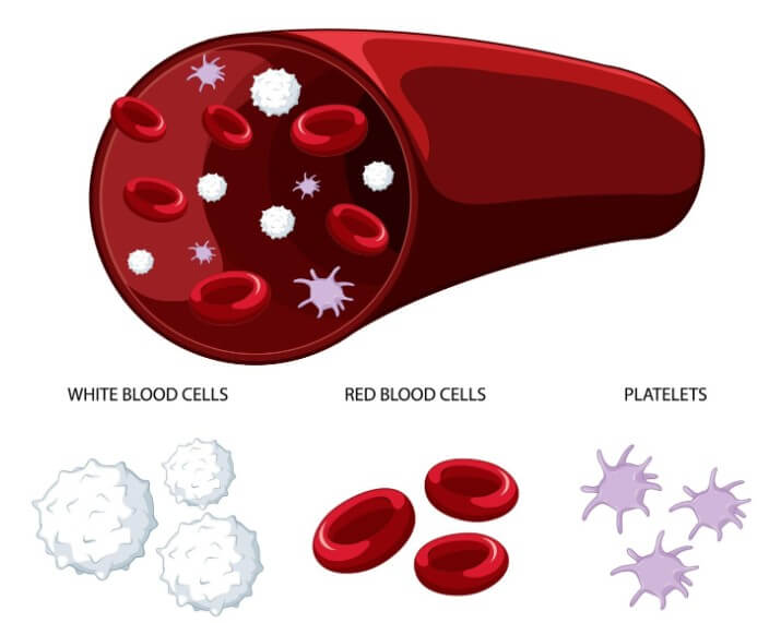 혈관 속 노폐물의 정도